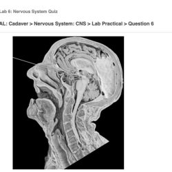 Nervous senses e10 lt