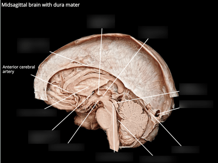 Pal cadaver nervous system cns lab practical question 1