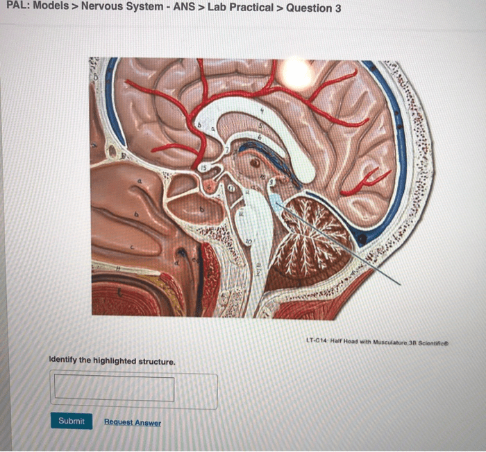 Pal cadaver nervous system cns lab practical question 1