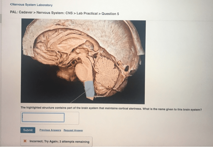 Practical lab pal senses special system nervous question models quizlet